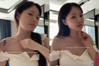 '애둘맘' 홍영기, 부은 얼굴 못 알아보겠네…괄사로 되찾은 미모